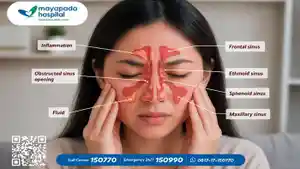 ayapada-Hospital-Surabaya-menyediakan-layanan-sinus-center.jpg