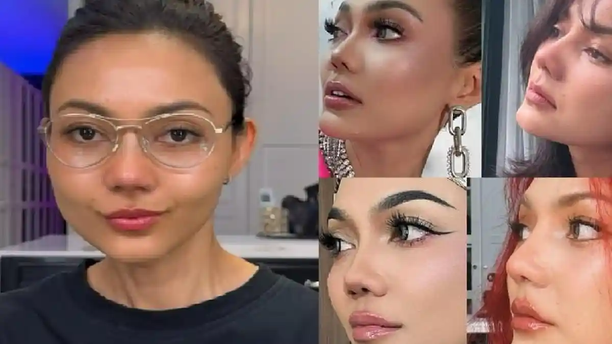 Rina Nose Pamer Hidung Operasi, Gegara Personal Branding, Sang Komedian ...