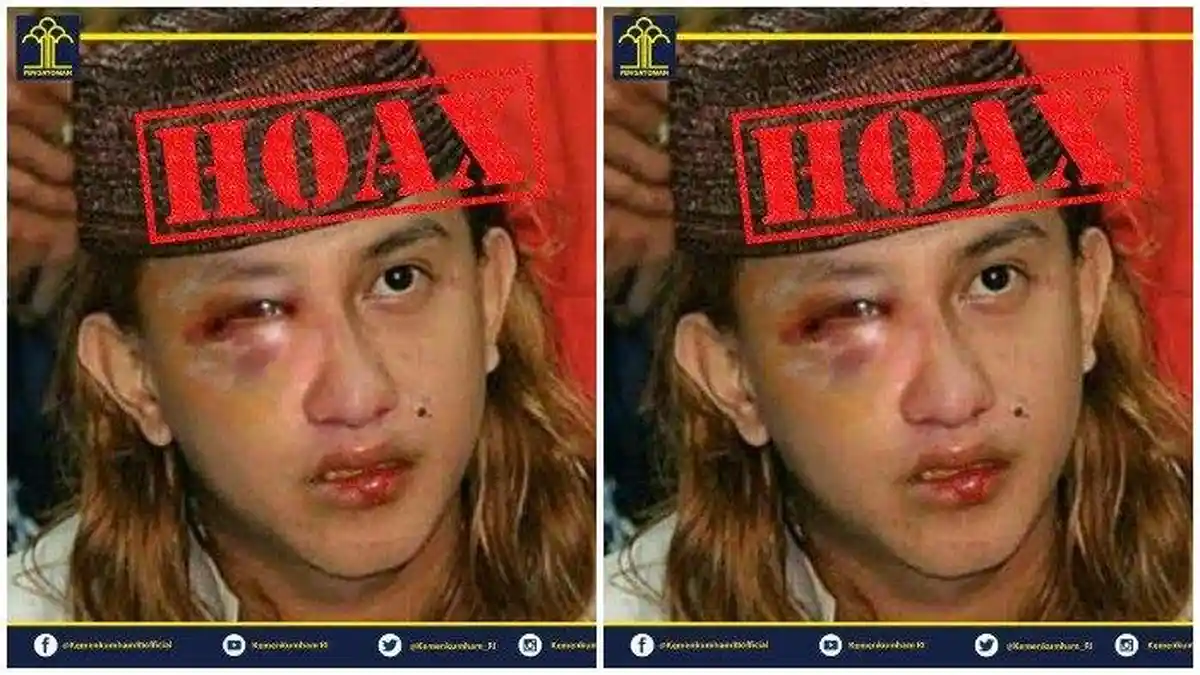 Beredar Kabar Habib Bahar bin Smith Dianiaya di Lapas, Kemenkumham Sebut Hoax, Ini penjelasannya