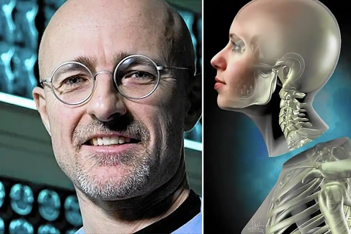 Wow, Transplantasi Kepala Manusia yang Kontroversial!