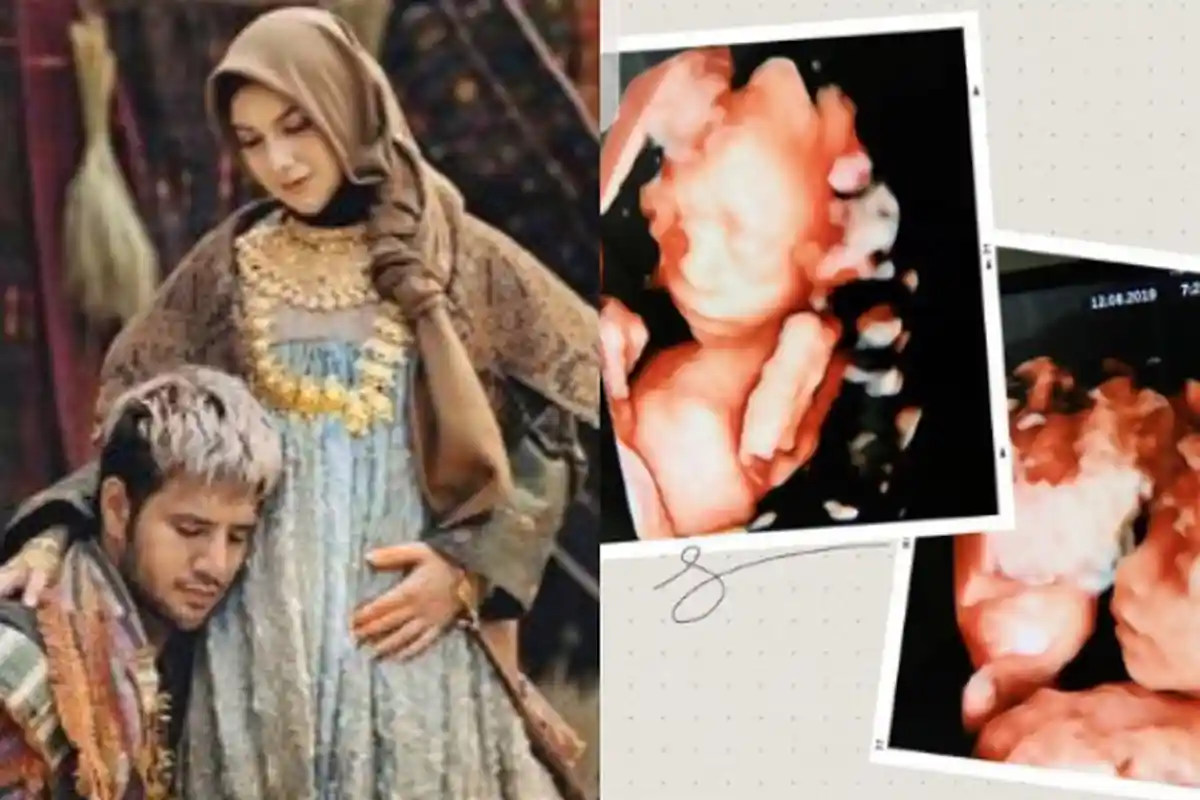 Banjir Dukungan dari Sahabat soal Meninggalnya Anak Irish Bella, Ammar Zoni: Keadaan Ini Menyakitkan