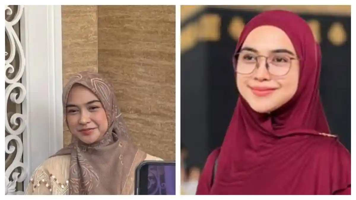 Sebelum Operasi Plastik Hidung, Ria Ricis Ngaku Rutin Minum Obat ...