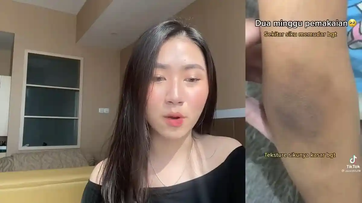 Cara Merawat Lutut dan Siku yang Gelap agar Lebih Halus dan Cerah