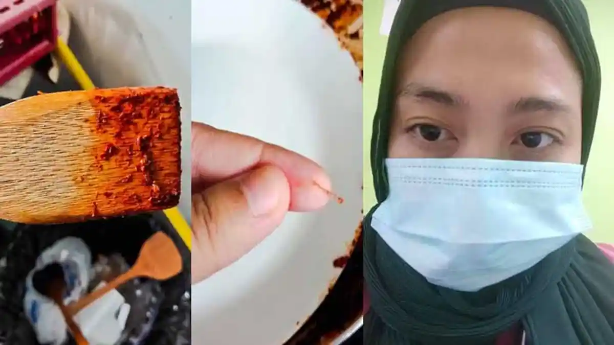 VIRAL Serpihan Kayu Spatula Tertelan saat Makan Sambal, Ibu Ini Kesakitan dan Harus Ditangani Dokter