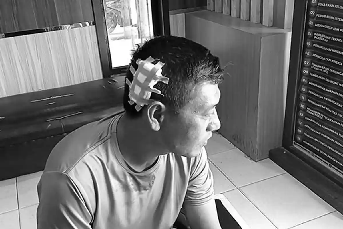 UPDATE Korban Bentrok Prajurit TNI AL dengan Brimob, 2 Polisi Luka-luka Jadi Sasaran Amukan