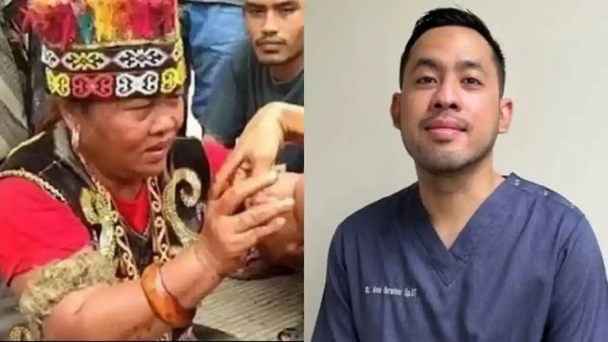 Ida Dayak Jadi Viral hingga Diserbu Ribuan Warga, Dokter Ini Ingatkan Fenomena Ponari: Anda Tergoda?