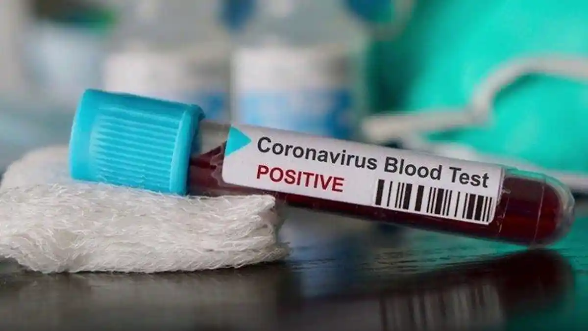 Update Corona Global, Kamis 17 Juli 2020, Malam: Total Pasien Covid-19 di Brasil Tembus 2 Juta Orang