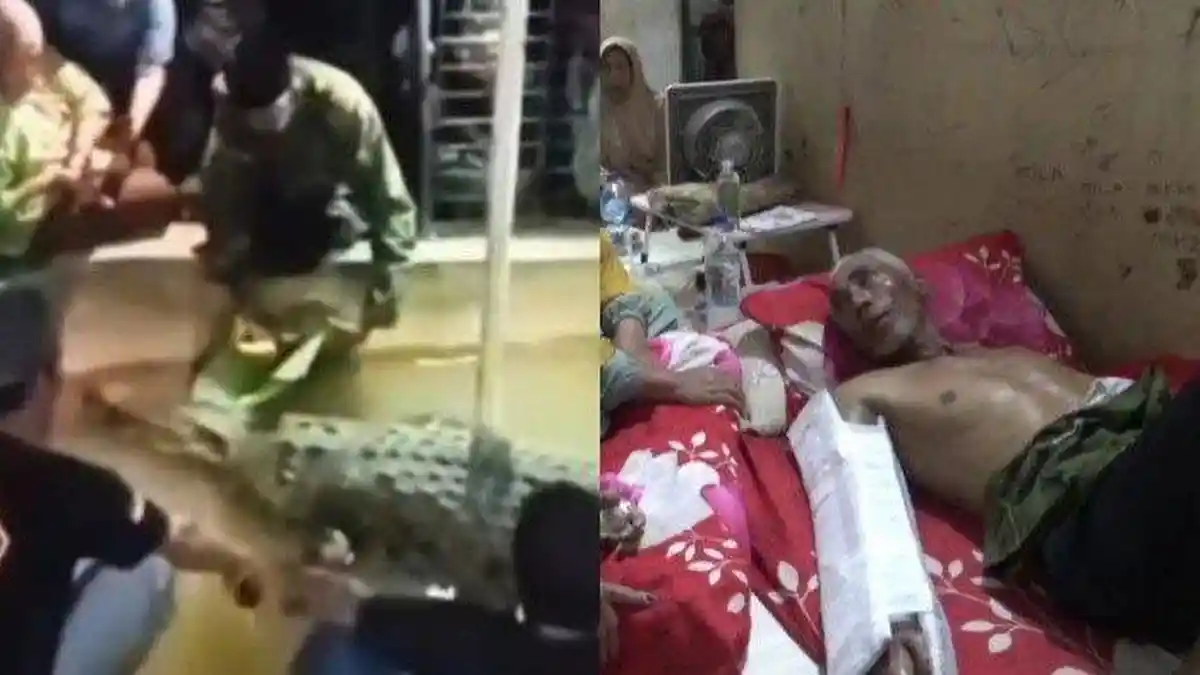 NASIB Kakek Digigit Buaya, tak Dioperasi Gara-gara Biaya Rp40 Juta, tak Ditanggung BPJS Cuma Dijahit