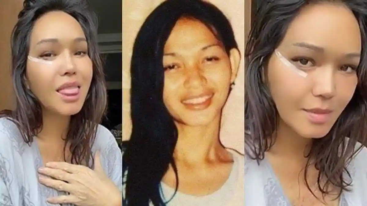 Viral Wajah Baru Bunda Corla Usai Operasi Plastik, Dipuji Warganet Jadi Lebih Cantik