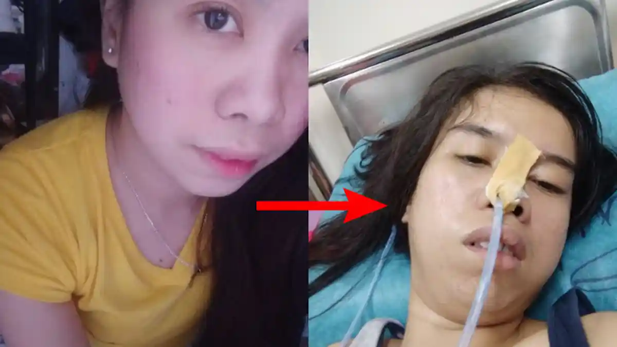 Demi Jagoan Mobile Legendnya Naik Level, Seorang Gamers Wanita Harus Rela Derita Stroke