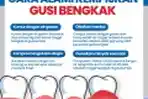 Infografis Cara Alami Kempiskan Gusi Bengkak