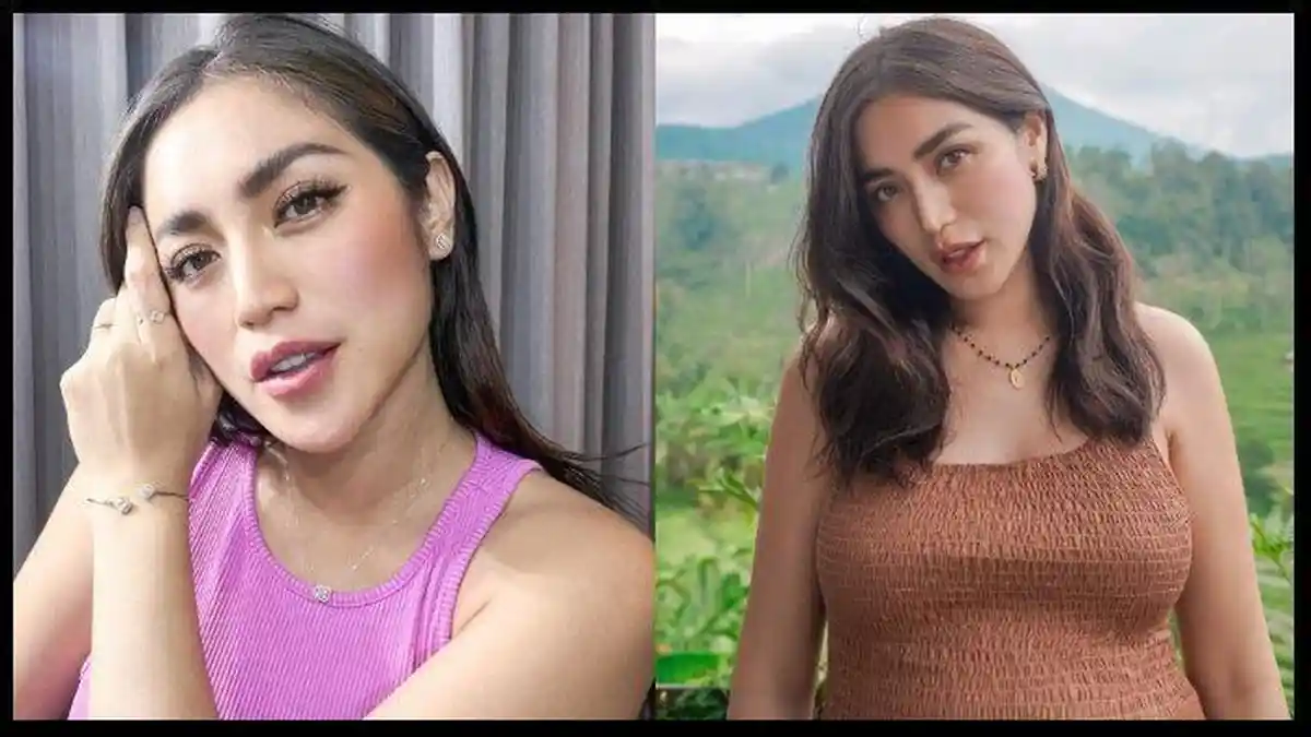 Jessica Iskandar Operasi Plastik Bagian Hidungnya di Korea Selatan