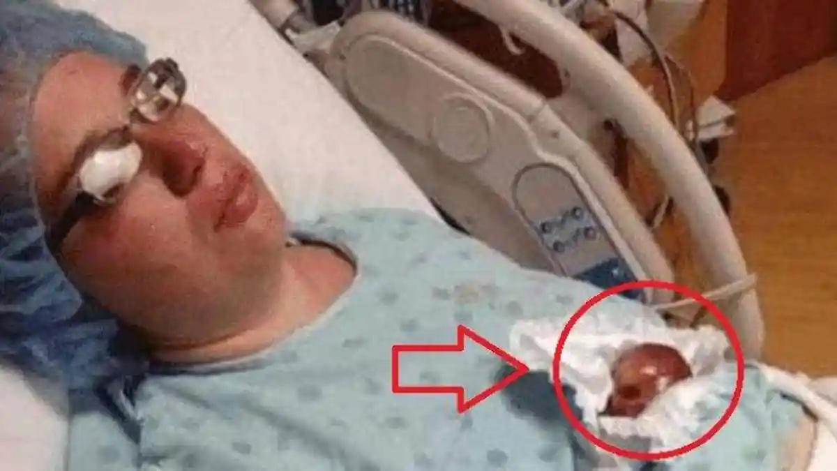 Masih Ingat Amelia Taylor saat Lahir Jadi Bayi Terkecil di Dunia? Begini Kabarnya Setelah 15 Tahun