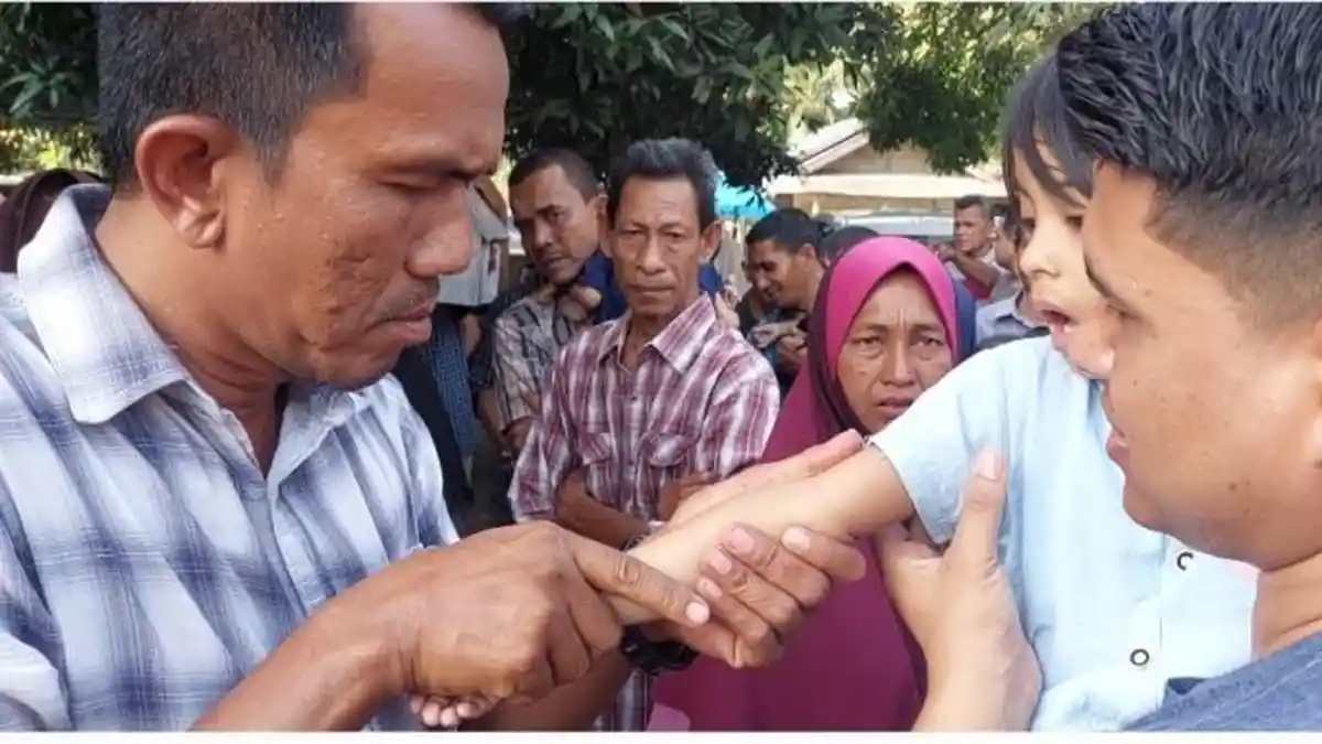 Heboh Ida Dayak, Di Aceh Ada Bang Man Urut, Sudah Lama Terkenal dan Ramai, Pengobatan Santai & Cepat