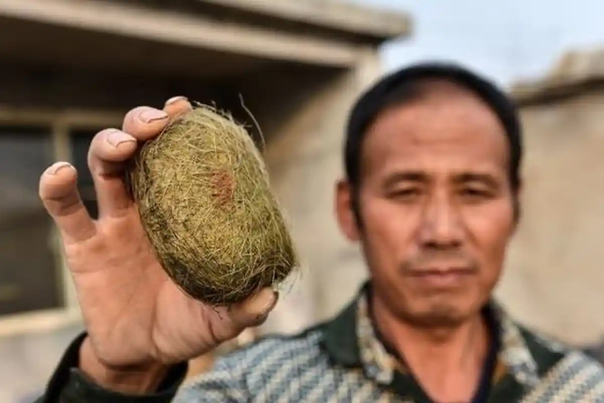 Pria Ini Jadi Kaya Mendadak Tak Sengaja Temukan Empedu Babi Miliknya