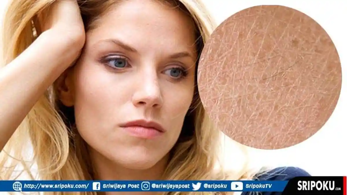 5 Hal Sepele Penyebab Kulit Kusam, Kamu Mungkin Tak Sadar Sering Melakukannya