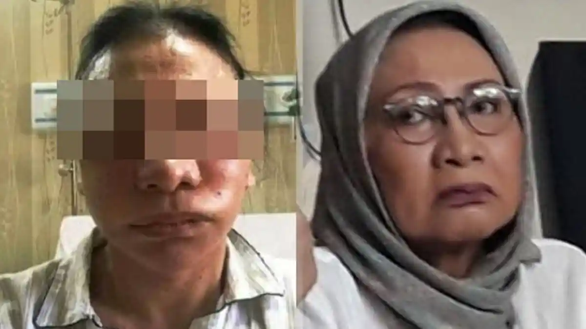 4 Poin Pengakuan Ratna Sarumpaet, Wajah Lebam karena Sedot Lemak hingga Sebut Nama Fadli Zon