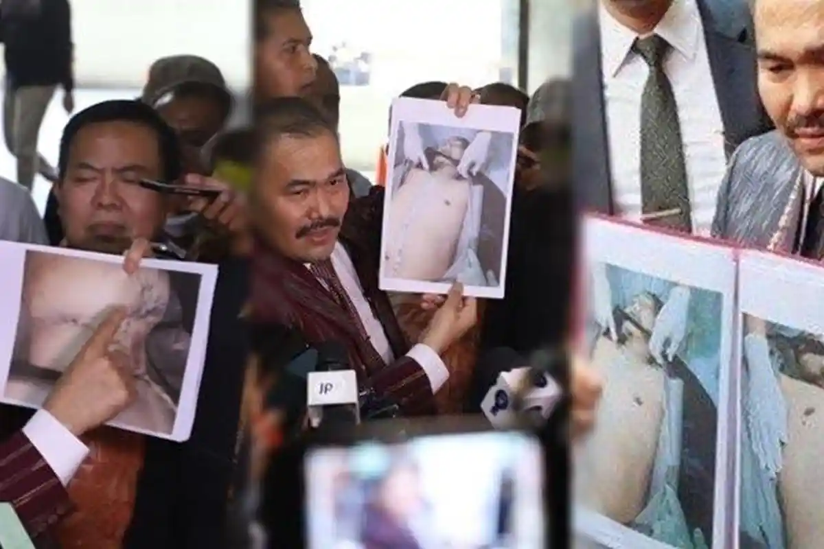 Baru Terungkap Kecurigaan Eks Kabareskirm dan IPW Terhadap Dokter Forensik yang Autopsi Brigadir J