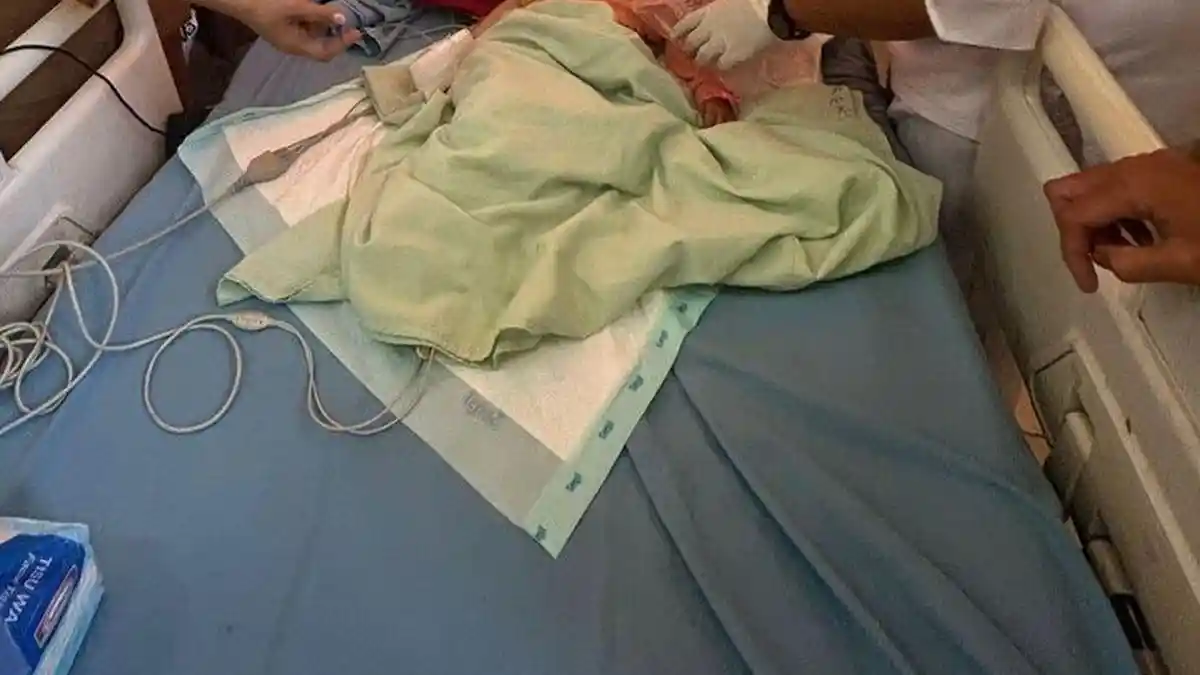 Serupa Raya, 2 Balita di Bengkulu Keluar Cacing dari Mulut dan Hidung, Dokter Ungkap Hasil Rontgen