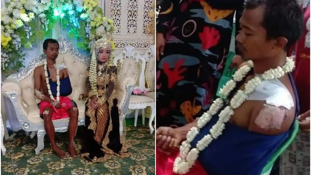 Pengantin Prianya Telanjang Dada, Bercelana Pendek, Tubuh Luka-luka, dan Tangan Digips, Ini Videonya
