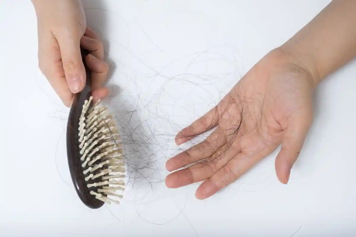 Cara Mengatasi Rambut Rontok Pakai Bahan Alami, Begini Cara Menggunakannya