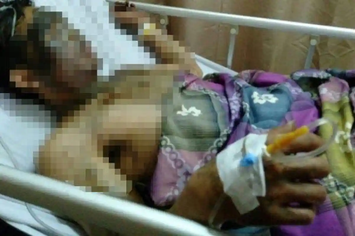 Nikahi Janda, Ustaz Tewas Dibunuh Pria Selingkuhan Istri, Badan Melepuh Disiram Air Keras