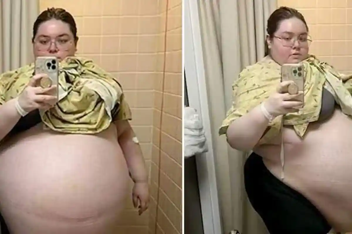 Gadis Curiga Perutnya Membesar, Dikira Hamil 10 Bayi, 'Organ Bak Hancur', Fakta Mengerikan Terungkap