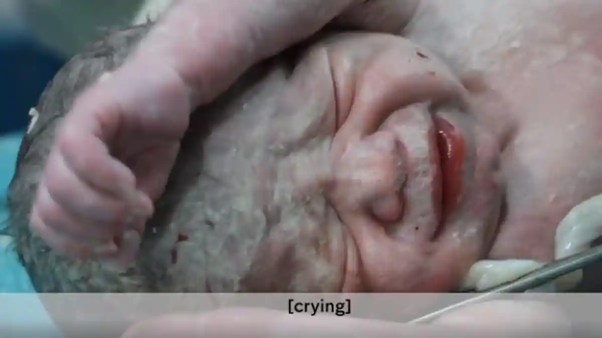 Ajaib! Ini Bayi yang Selamat dalam Serangan Udara di Suriah