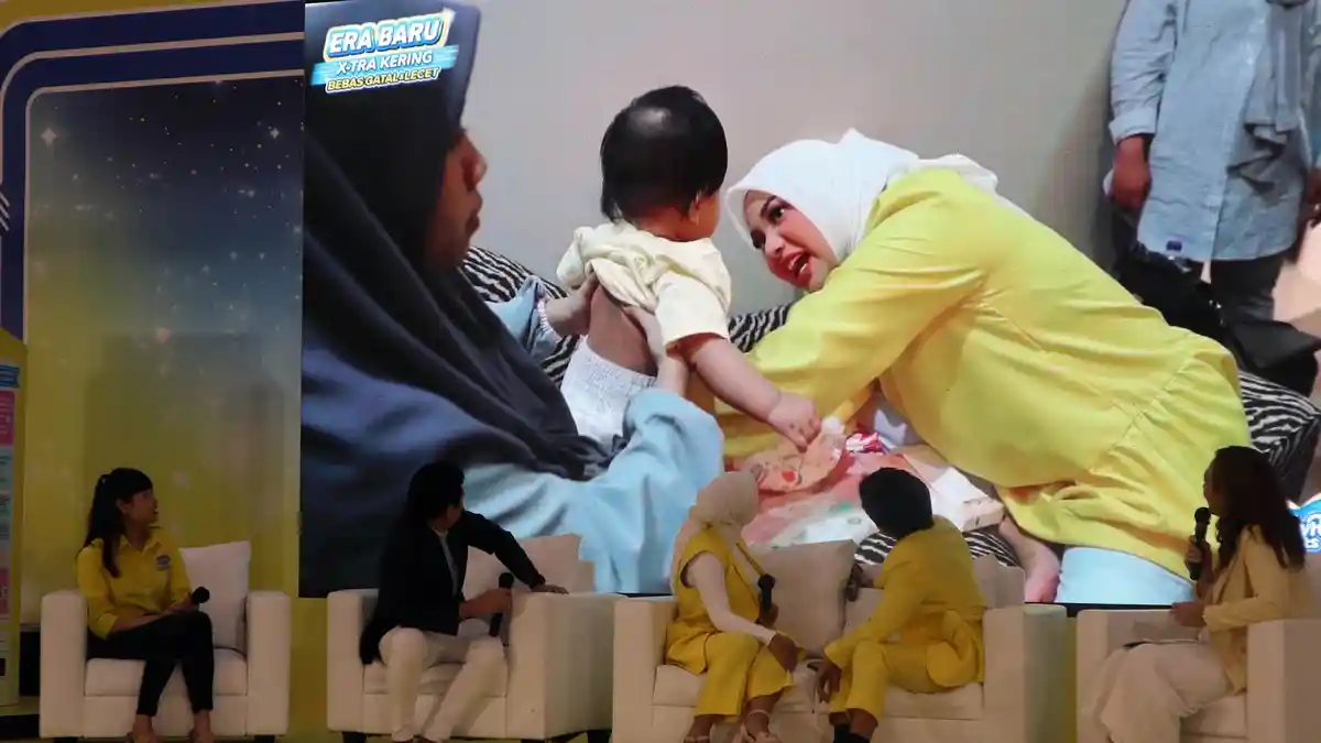 Aurel Bingung Saat Kulit Ameena Gatal-gatal, Minta Bantuan KD dan Ashanty Mengetahui Apa Penyebabnya