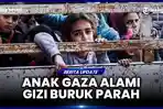 65.000 Anak Gaza Terkena Malnutrisi Akut Karena Israel Blokade Bantuan Sejak 2 Maret