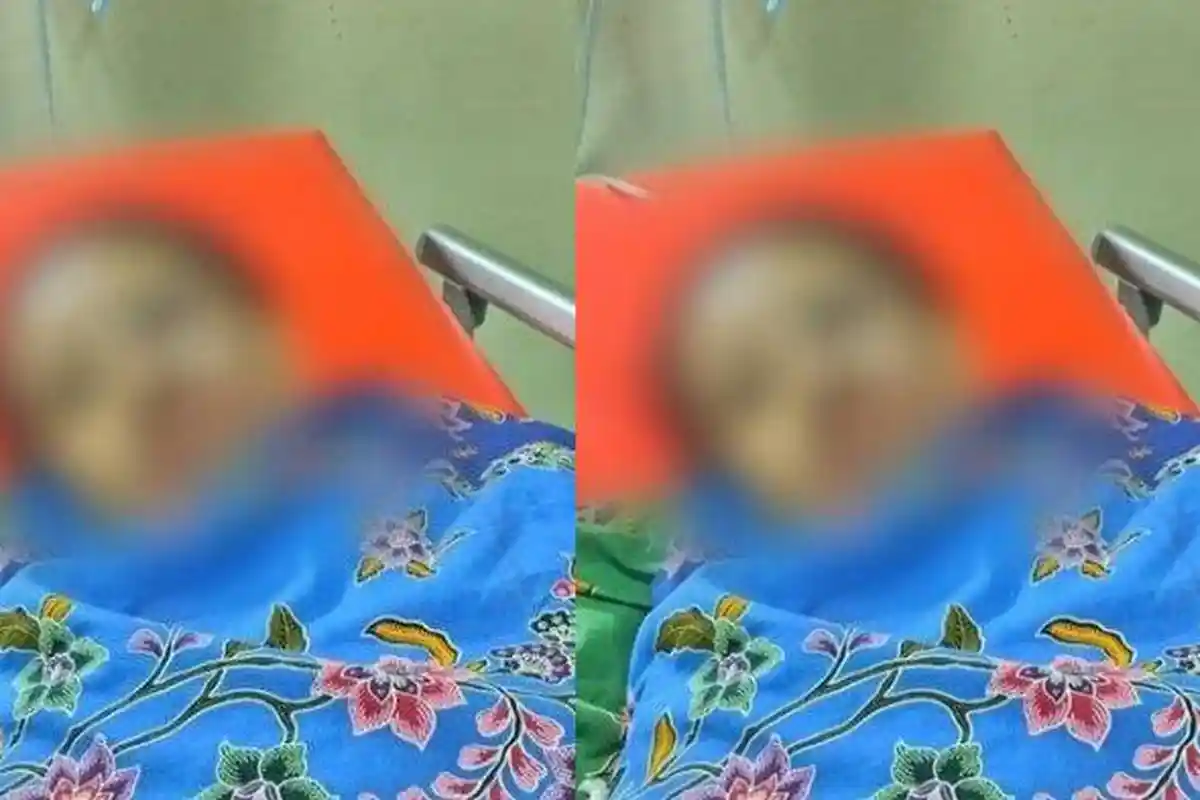 Kisah Susanti Disiram Air Keras Suami Sampat Kritis Alami Luka Bakar 30 Persen, Pelaku Masih Buron