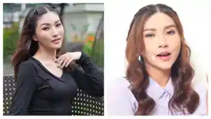 sarwendah-oplas.jpg