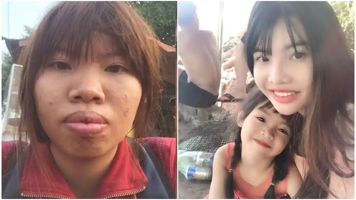Berubah Cantik Berkat Oplas, Wanita Bungkam Nyinyir Tetangga, 2 Kali Nikah, Anaknya Rupawan Semua
