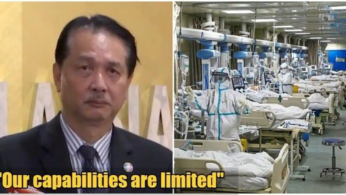 Dirjen Kesehatan Malaysia Sebut Jika Ada Lonjakan Pasien Terpaksa Pilih Siapa yang Pakai Ventilator