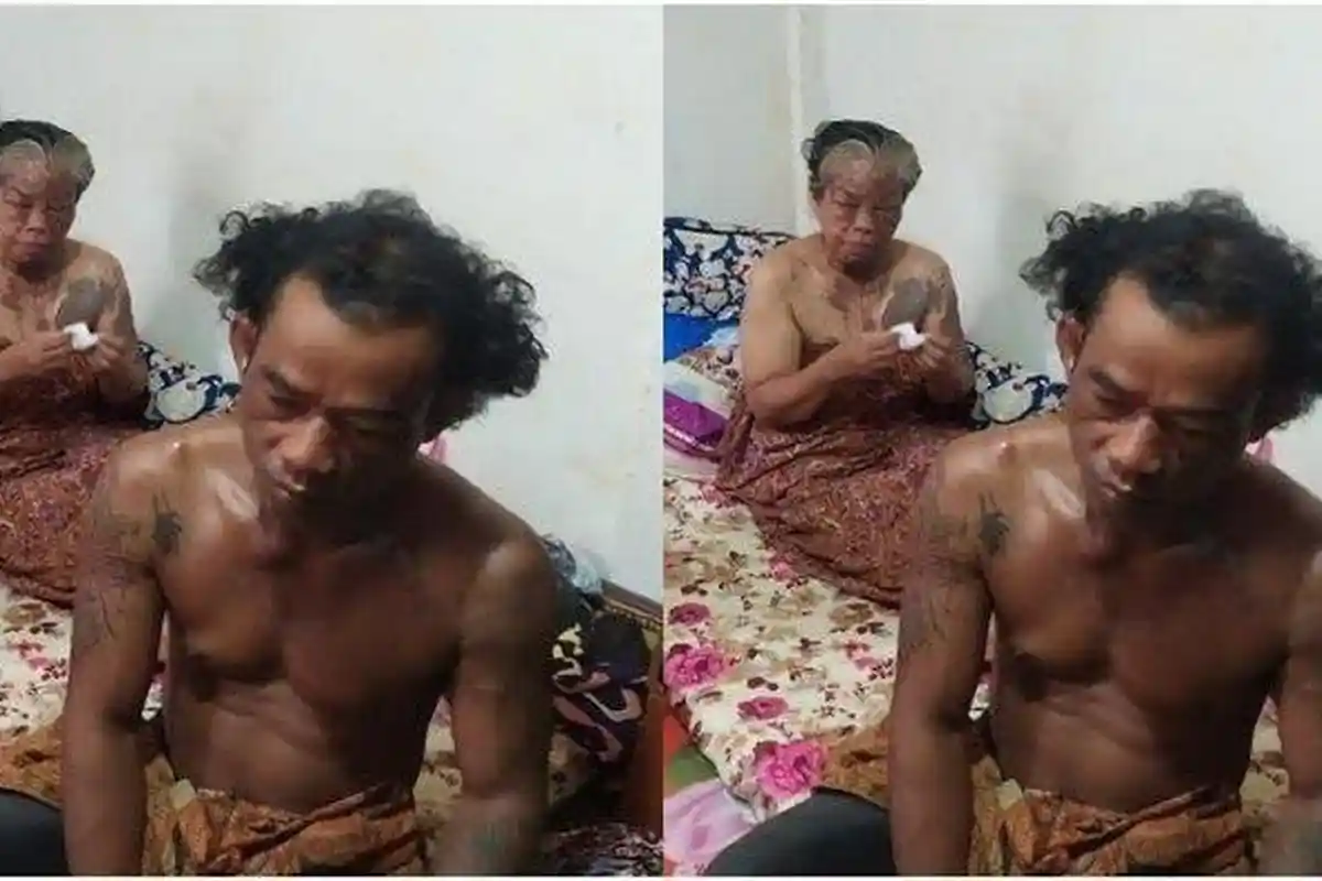 Fakta-fakta Satu Keluarga Disiram Air Keras Oleh Orang Tak Dikenal: Masuk Rumah Bawa Parang & Pedang