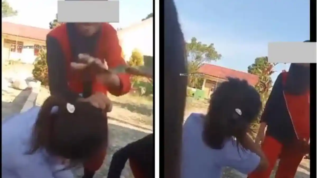 Viral Siswi SD Masuk Rumah Sakit Karena Dibully Temannya, Rambut Dijambak Leher Dipelintir