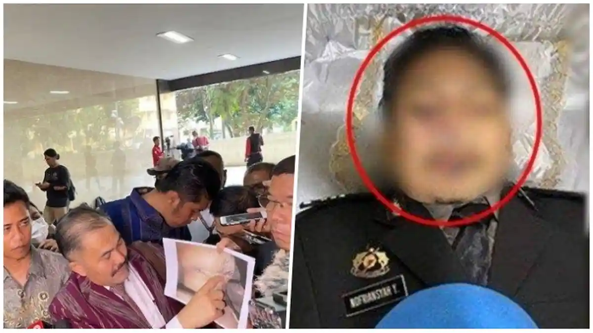 Baru Terungkap Polri Terima Permohonan Autopsi Ulang Brigadir J, Libatkan Kedokteran Forensik