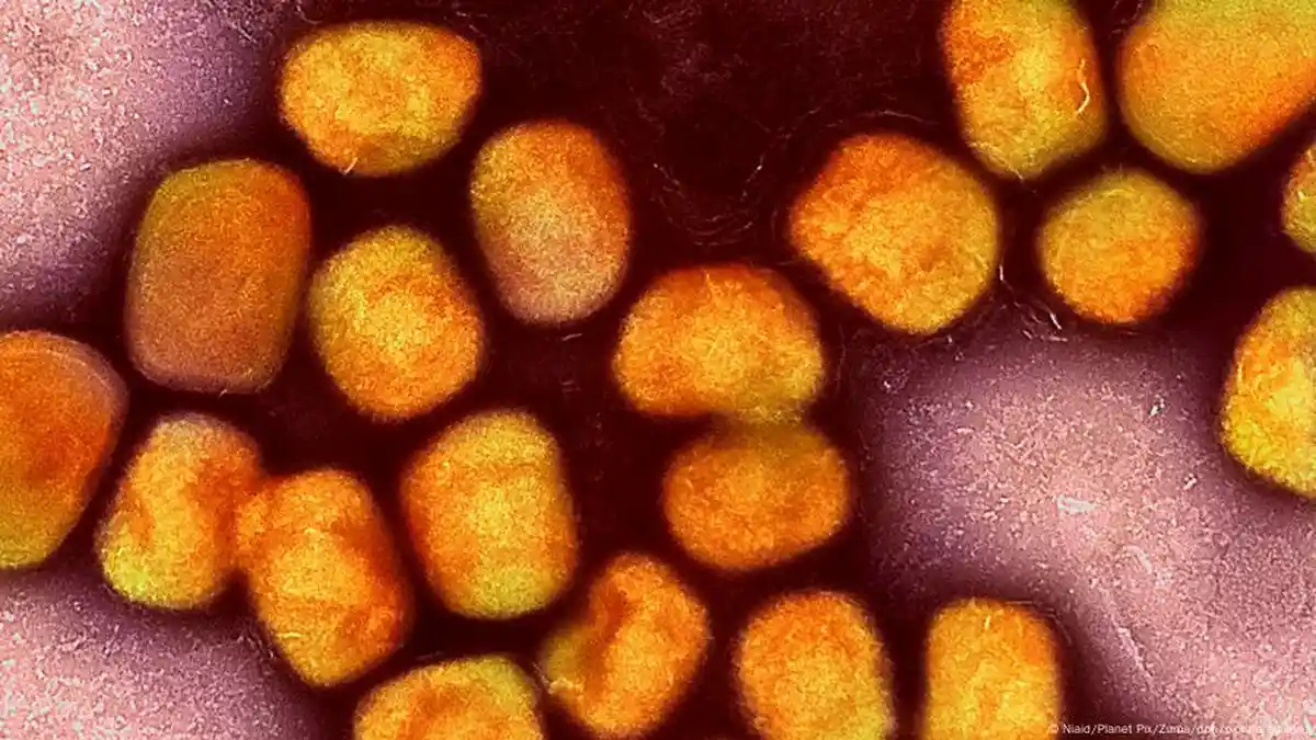 Cek Fakta: Tidak ada Kaitan antara Mpox dan Vaksinasi COVID