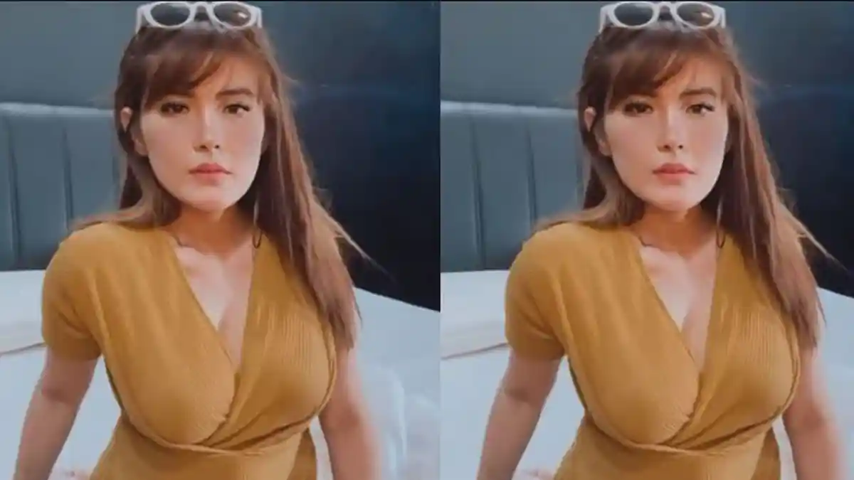 Angela Lee Nyesal Lakukan Operasi Hidung, Implan Jebol Sampai Tembus ke Kulit