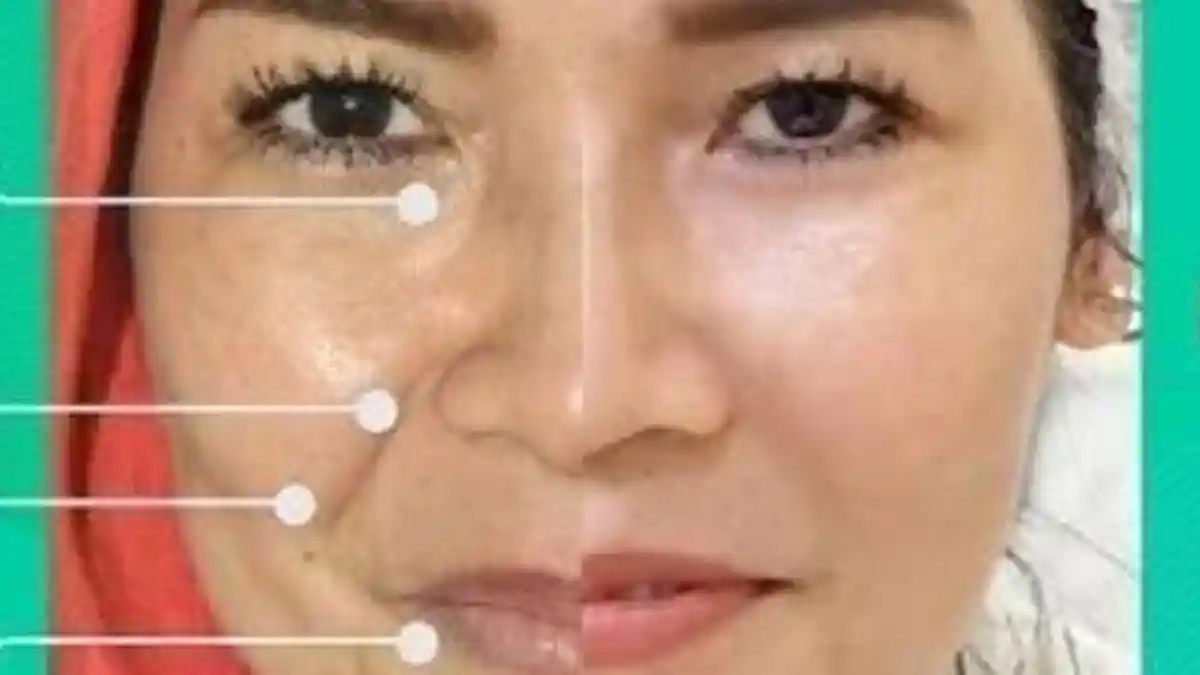 Intip Transformasi Wajah Umi Kalsum Pasca Dipermak Sana-sini, Dagu Jadi Lancip dan Pipinya Tirus