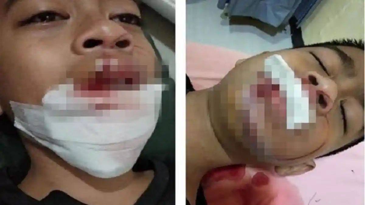 Wajib Hati-hati! Tak Sengaja Bakar Botol Pengharum Ruangan, Seorang Bocah Alami Hal Mengerikan