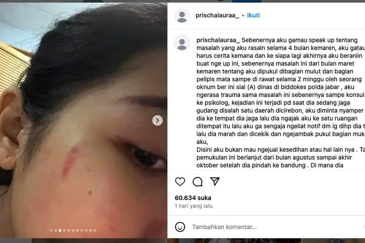 Pengakuan Chaca Dianiaya Oknum Polisi yang Berdinas di Polda Jabar: Dicekik dan Dipukul di Wajah