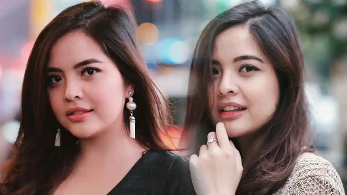 Kondisi Tasya Kamila Gara-gara Soflens Sobek Lalu Tersangkut di Mata Selama 2 Hari
