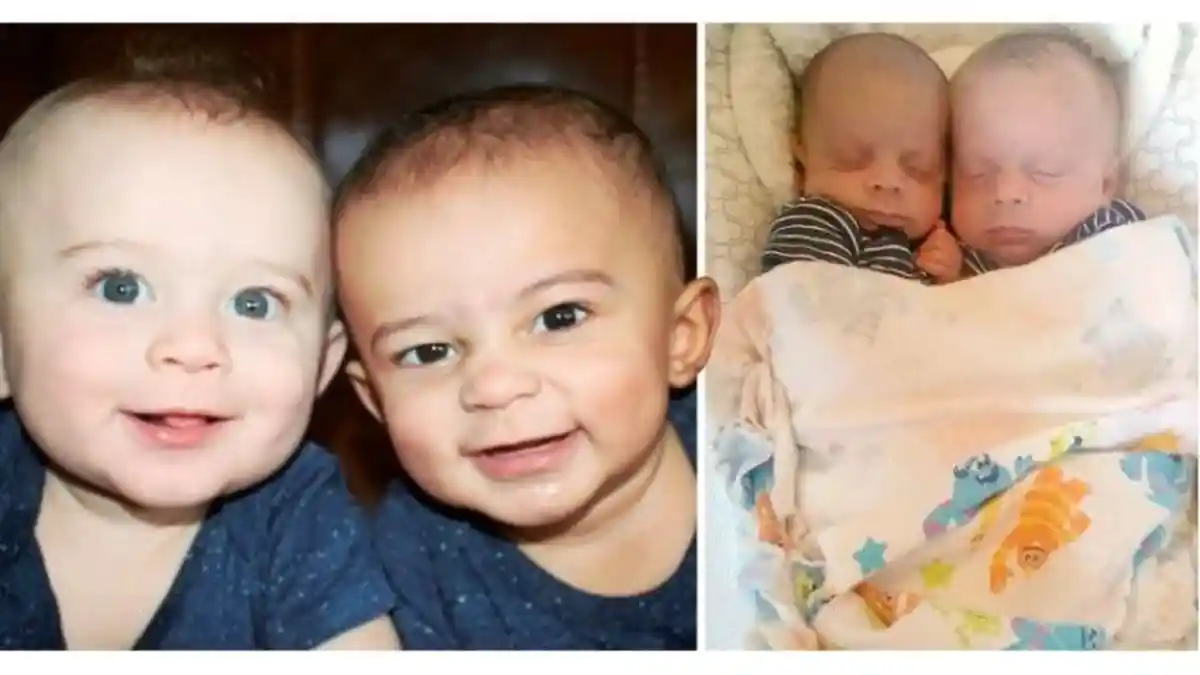 Unik, Dua Bayi Kembar Terlahir dengan Kulit yang Berbeda, Sang Ibu Khawatir Soal Ini