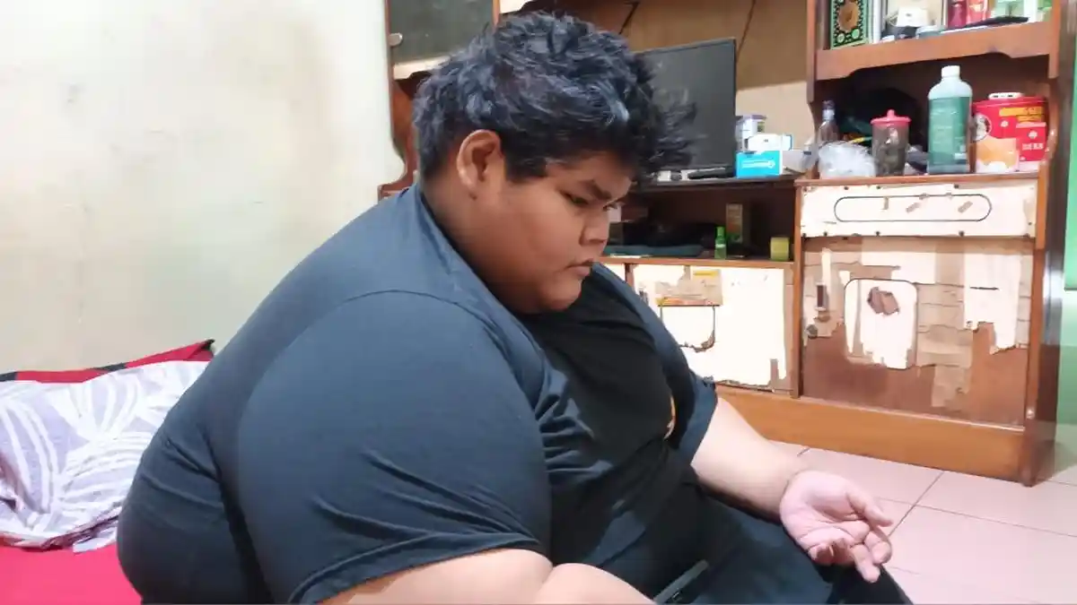 Terkuak Pola Makan Remaja Obesitas 200 Kg di Cipayung, Berat Badan Naik Drastis di Usia 17 Tahun