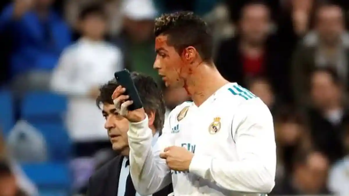 Kepalanya Berlumuran Darah, Cristiano Ronaldo Sempet Banget Ngaca
