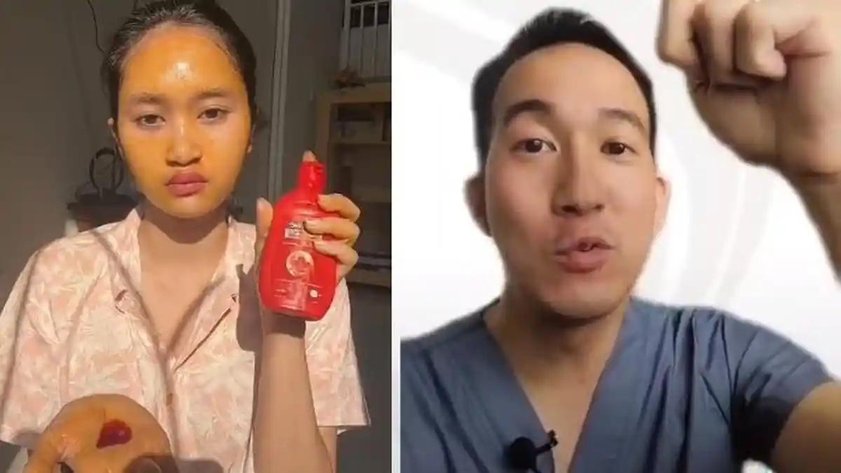 Viral Anak Farida Nurhan Bisa Hilangkan Jerawat Cuma Pakai Betadine, Amankah? Begini Kata dr Arthur