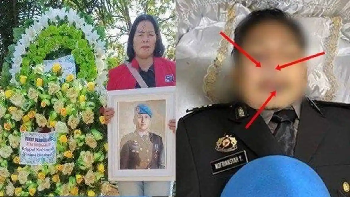 Akhirnya Hasil Autopsi Brigadir J Diumumkan Forensik, dari Luka Tubuh Bisa Terungkap Faktanya