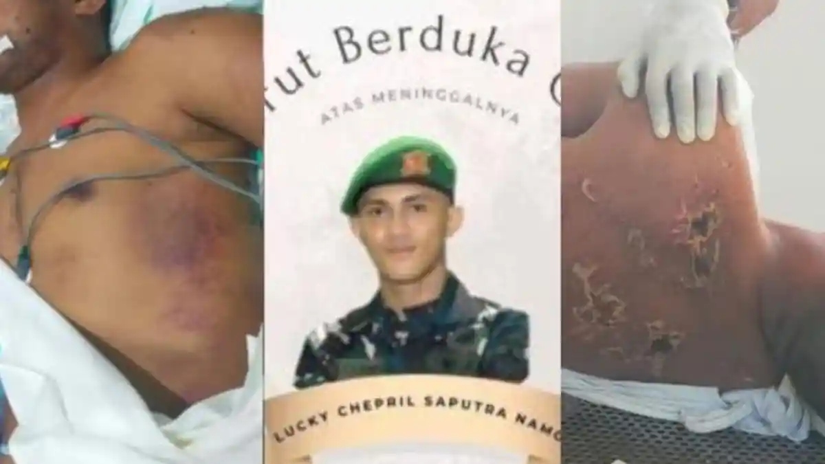 SOSOK Komandan Peleton Izinkan Prada Lucky Disiksa 20 Senior Sampai Ginjal Pecah Ternyata Masih Muda