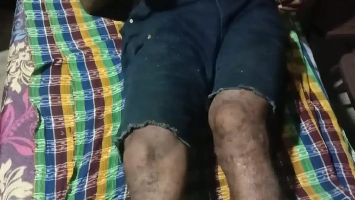 Pohon Kemiri Tumbang, Warga Doreng Sikka Meninggal Dunia 